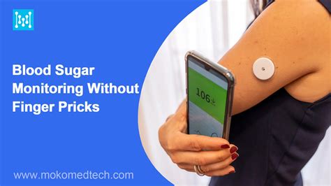 glucose monitoring without finger prick